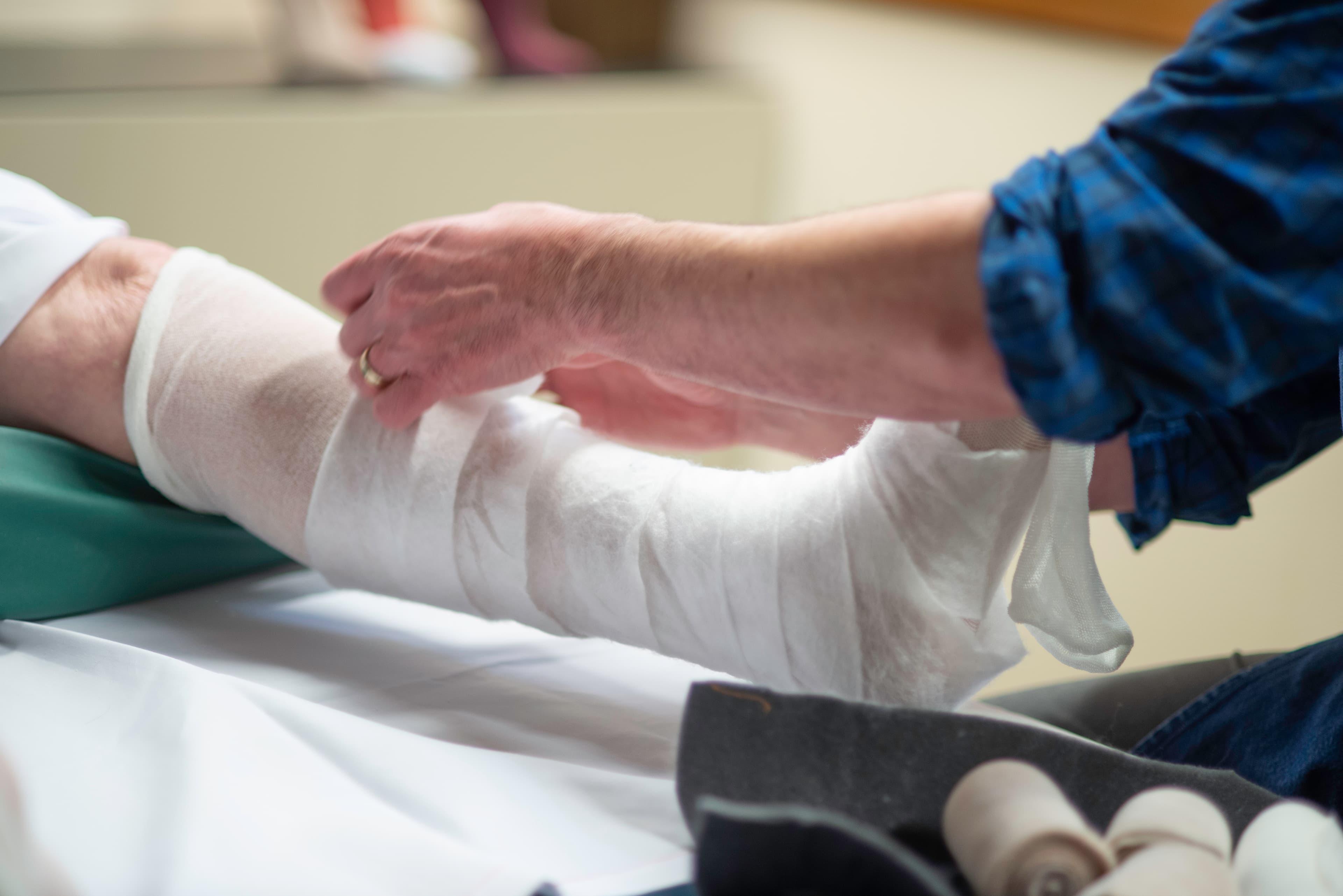 Lymphedema specialist applying customized compression bandage during intensive phase of CDT.