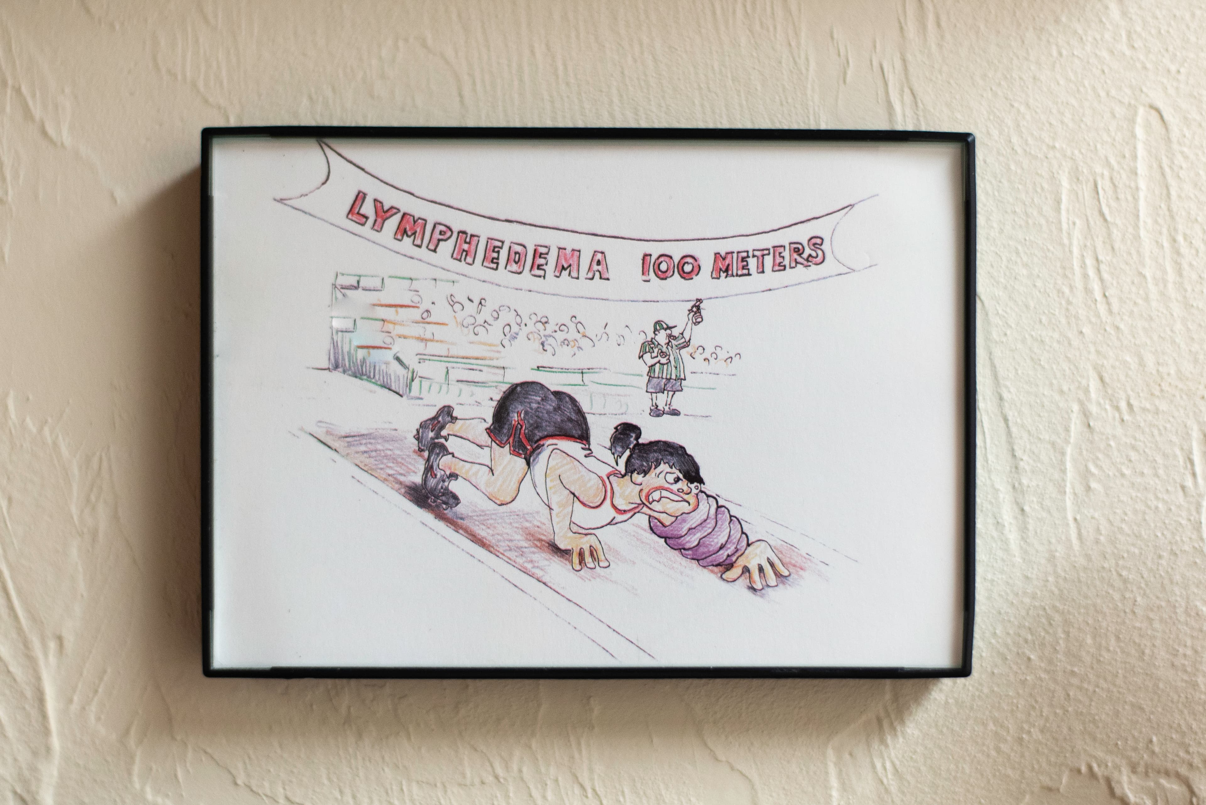Photo of a framed comic depicting a runner at the start of a race with a purple lymphedema bandage on their arm in front of a banner reading "Lymphedema 100 meters"